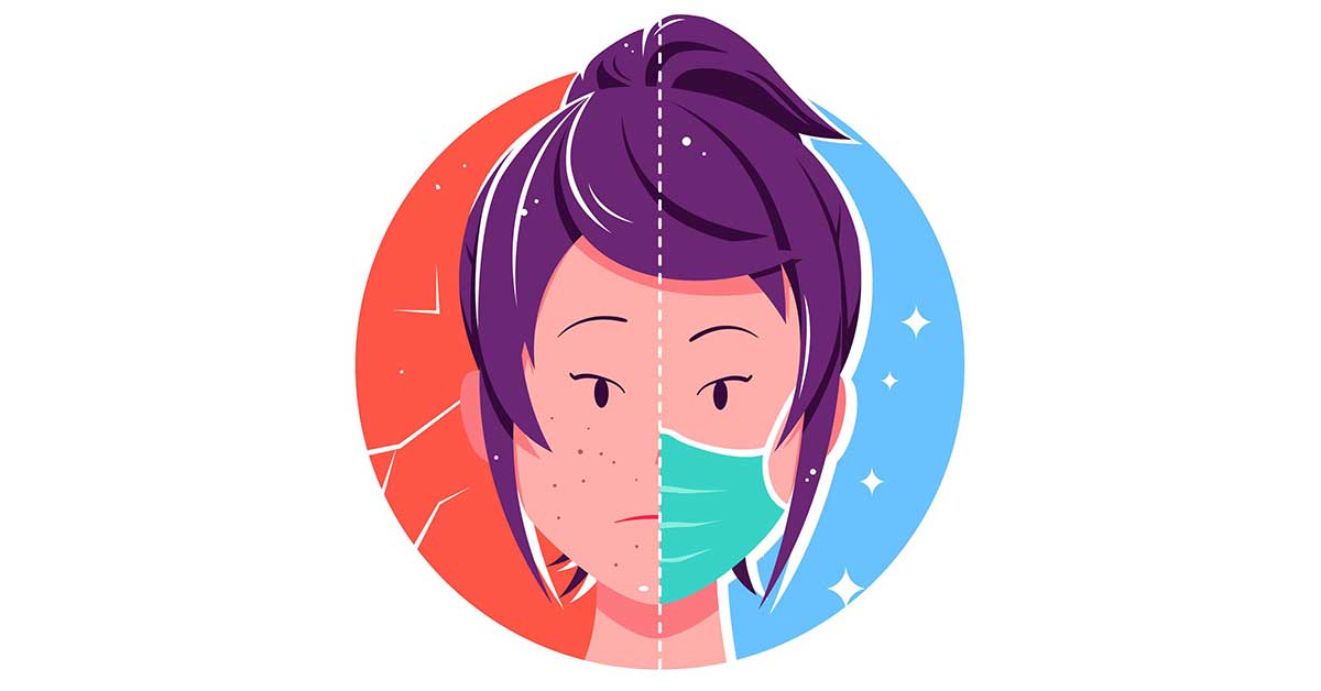 Wearing a face mask causing acne breakouts? Here's how you can avoid t